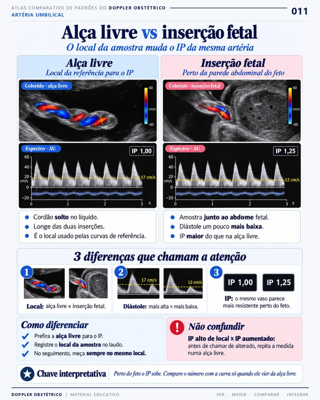 Página 11: Alça livre e inserção fetal. Trecho do PDF de Doppler Obstétrico e Fetal.